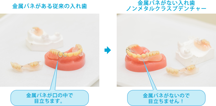 入れ歯・義歯