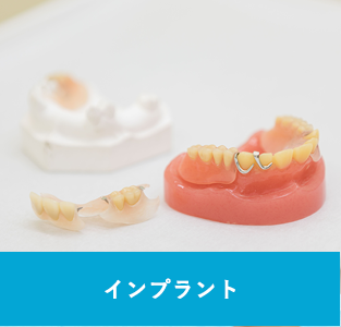 インプラント